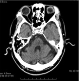 頭部CT検査画像